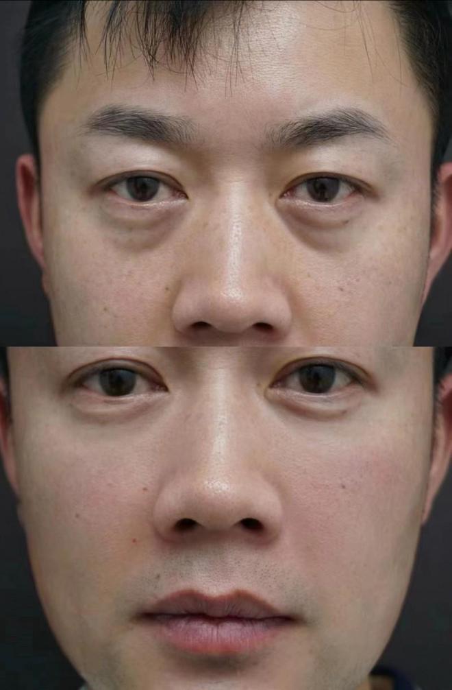 肤品推荐专业测评值得信赖AG真人网页淡纹抗皱护(图6)