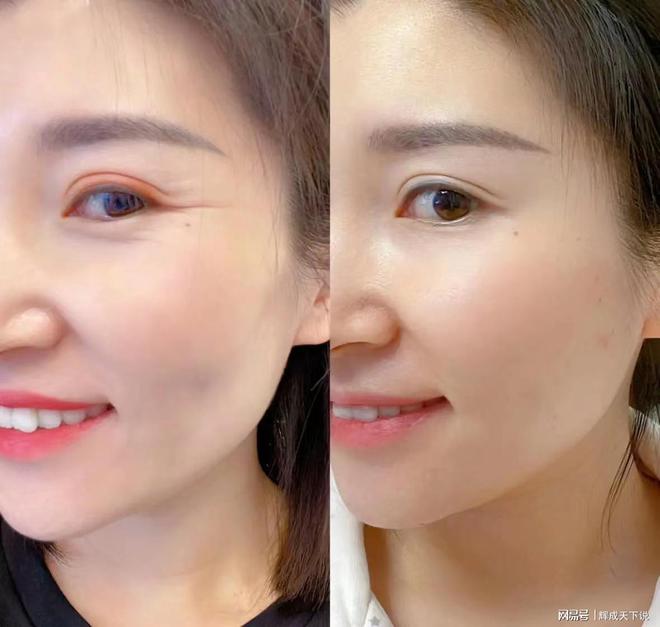 好？抗皱眼霜品牌Top7最受欢迎的品牌AG真人百家家乐APP去皱眼霜哪个牌子(图6)